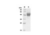 Recombinant Mouse TSLP Protein (Fc Tag) (RPES8458)