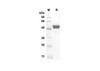 Recombinant Rat GM-CSF Protein (Fc Tag) (RPES8518)