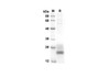 Recombinant Rat GM-CSF Protein (His Tag) (RPES8527)
