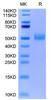 Biotinylated Recombinant Mouse GFR alpha-like/GFRAL Protein (RPCB0019)