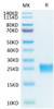 Biotinylated Recombinant Human IL-17F Protein (RPCB0037)