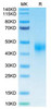 Biotinylated Recombinant Human TFPI Protein (RPCB0039)