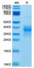 Biotinylated Recombinant Human NKG-2D/KLRK1/CD314 Protein (RPCB0049)