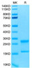 Biotinylated Recombinant Human IL-17A&IL-17F Protein (RPCB0053)