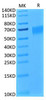 Biotinylated Recombinant Human IL-17RA/CD217 Protein (RPCB0057)