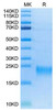 Biotinylated Recombinant Human TNFRSF13C/BAFFR/CD268 Protein (RPCB0058)