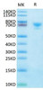 Biotinylated Recombinant Human Mesothelin/MSLN Protein (RPCB0061)