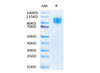 Biotinylated Recombinant Human PDGFR-beta/CD140b Protein (RPCB0063)