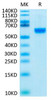Biotinylated Recombinant Human ROR2 Protein (RPCB0065)