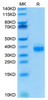 Biotinylated Recombinant Human Ep-CAM/TROP-1/CD326 Protein (RPCB0066)