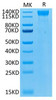 Biotinylated Recombinant Human VEGFR-2/KDR/CD309 Protein (RPCB0067)