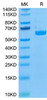 Biotinylated Recombinant Human LAG-3/CD223 Protein (RPCB0068)