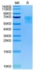 Biotinylated Recombinant Human WAIF1/5T4/TPBG Protein (RPCB0078)