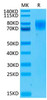 Biotinylated Recombinant Human IFNAR1 Protein (RPCB0079)