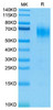 Biotinylated Recombinant Human IL-13RA1/CD213a1 Protein (RPCB0080)