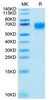 Biotinylated Recombinant Human IL-2RG/CD132 Protein (RPCB0082)