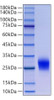Recombinant Human Thy-1/CD90 Protein (RPCB0086)