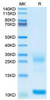 Biotinylated Recombinant Human Thymic stromal lymphopoietin/TSLP Protein (RPCB0087)
