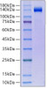 Recombinant Human Klotho beta/KLB Protein (RPCB0090)