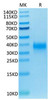 Biotinylated Recombinant Human KP43/KLRD1/CD94 Protein (RPCB0093)