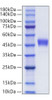 Recombinant Human CXC-chemokine receptor 1/CXCR1 Protein (RPCB0107)