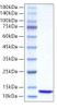 Recombinant Human Ubiquitin protein (RPCB0121)