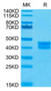 Biotinylated Recombinant Human Cell surface A33 antigen/GPA33 Protein (RPCB0124)