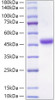 Recombinant Human Neutrophil cytosol factor 1/NCF1 Protein (RPCB0130)