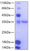 Recombinant Human TIE2/TEK/CD202b Protein (RPCB0135)