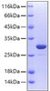 Recombinant Human Carbonic anhydrase 2 Protein (RPCB0139)