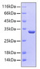 Recombinant Human Sulfotransferase 1A1/SULT1A1 Protein (RPCB0141)