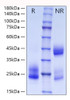 Recombinant Human CD69 Protein (RPCB0154)