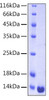 Recombinant Human Galectin-1/LGALS1 Protein (RPCB0160)