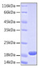 Recombinant Human UBE2L3 Protein (RPCB0163)