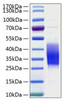Recombinant Human TIM-3/HAVCR2/CD366 Protein (RPCB0167)