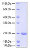 Recombinant Human FGF-21 Protein (RPCB0171)