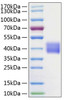 Recombinant Human Kallikrein-1/KLK1 Protein (RPCB0173)