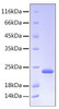 Recombinant Human Somatotropin/GH-N/GH1 Protein (RPCB0180)