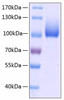 Recombinant Human LIMP II/SCARB2/CD36L2 Protein (RPCB0185)