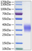Recombinant Human Ephrin-B2/EFNB2 Protein (RPCB0186)