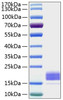 Recombinant Human TIGIT Protein (RPCB0187)