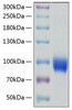 Recombinant Human IL-18R1/CD218a Protein (RPCB0194)