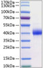 Recombinant Human Kallikrein-11/KLK11 Protein (RPCB0196)