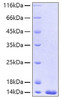 Recombinant Human FABP4/A-FABP/ALBP(A29T) Protein (RPCB0198)