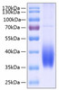 Recombinant Human B7-DC/PD-L2/CD273 Protein (RPCB0211)