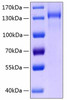 Recombinant Human TIE2/TEK/CD202b Protein (RPCB0218)