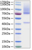 Recombinant Human Glypican-3/GPC3 Protein (RPCB0230)