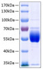 Recombinant Human Serpin C1/Antithrombin-III Protein (RPCB0234)