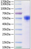 Recombinant Human NKp30/NCR3/CD337 Protein (RPCB0241)