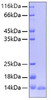 Recombinant Human Leptin/LEP Protein (RPCB0242)